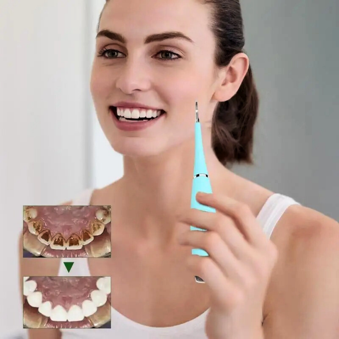 SmileSonic™- At-Home Ultrasonic Tooth Cleaner