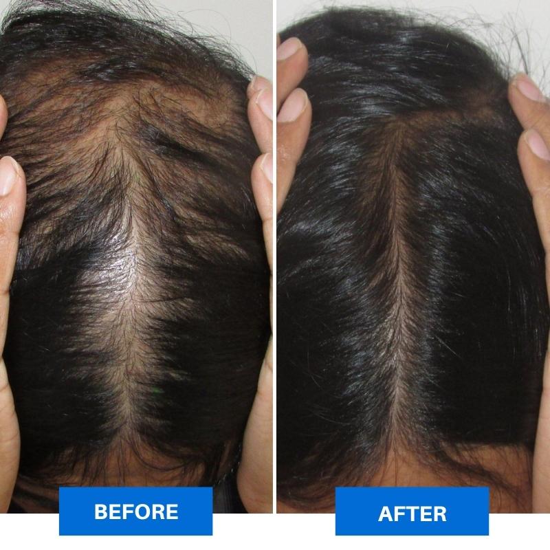 Scalpify™ - Smart Scalp Massager
