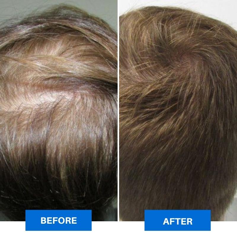 Scalpify™ - Smart Scalp Massager